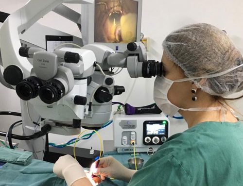 Laser micropulso é nova opção de tratamento de glaucoma